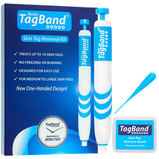 TagBand Skin Tag Removal